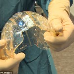 Crâne imprimé en 3D