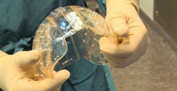 Crâne imprimé en 3D