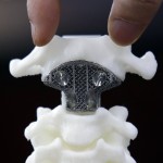 Vertèbre imprimée en 3D
